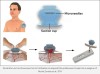 Un nouveau dispositif inspiré de la sangsue pour prélever facilement du sang (de façon peu invasive) et qui ne nécessite pas de formation médicale