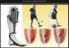 futura-sciences - Cette prothèse est directement implantée dans l’os et greffée aux muscles