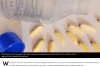 Very Hungry Plastivore Caterpillars Get Fat From Eating Plastic