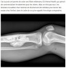 sciencepost - Cancer : Le traitement qui a sauvé des chiens pourrait bientôt sauver des enfants