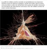 sciencesetavenir - Sclérose en plaques : la greffe de cellules souches, peut être un un traitement d'avenir (étude sur souris)
