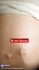 Scilabus - Peut-on voir les FOETUS à travers la peau (non)