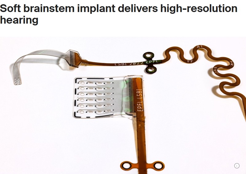 EPFL - Soft brainstem implant delivers high-resolution hearing