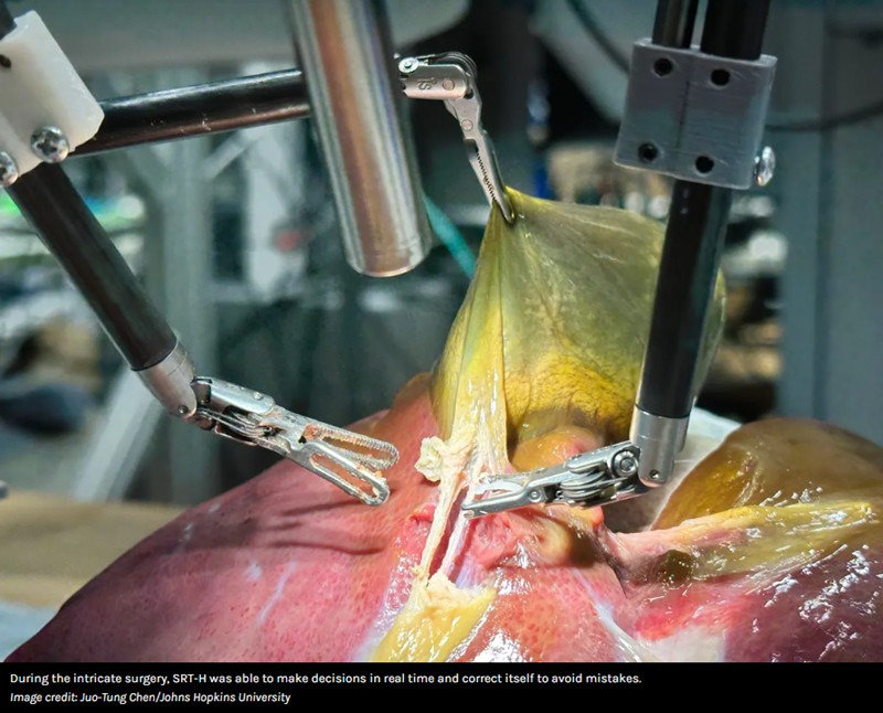 iflscience - In A First, A Robot Listened To Spoken Instructions And Performed Surgery – Just Like A Human Would