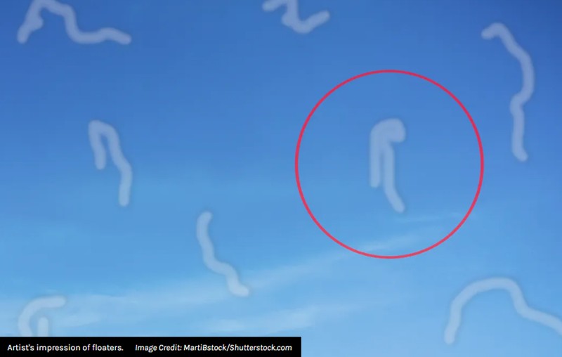 iflscience - What Are Those Strange Eye Floaters You See In Your Vision?