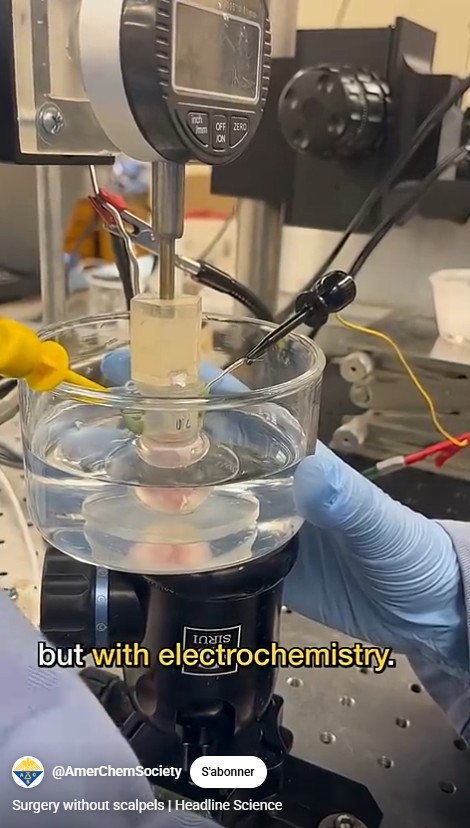 sciencepost - « remodelage électromécanique » (REM) pour sculpter la cornée