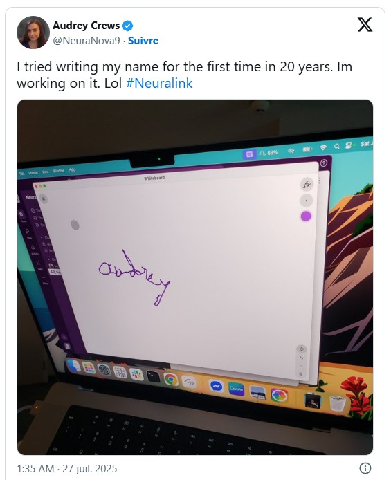 sciencepost - Des news de la nouvelle puce cérébrale d’Elon Musk