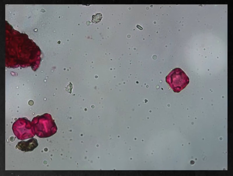 Scilabus - Pourquoi planter des arbres qui nous font suffoquer