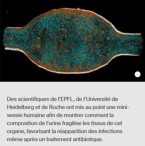 EPFL - Une mini-vessie humaine révèle la cause des infections récurrentes
