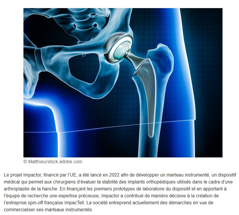 Cordis - Des nouvelles du projet Impactor: impulser l’innovation dans le domaine de la chirurgie de remplacement de la hanche grâce au marteau intelligent d’ImpacTell
