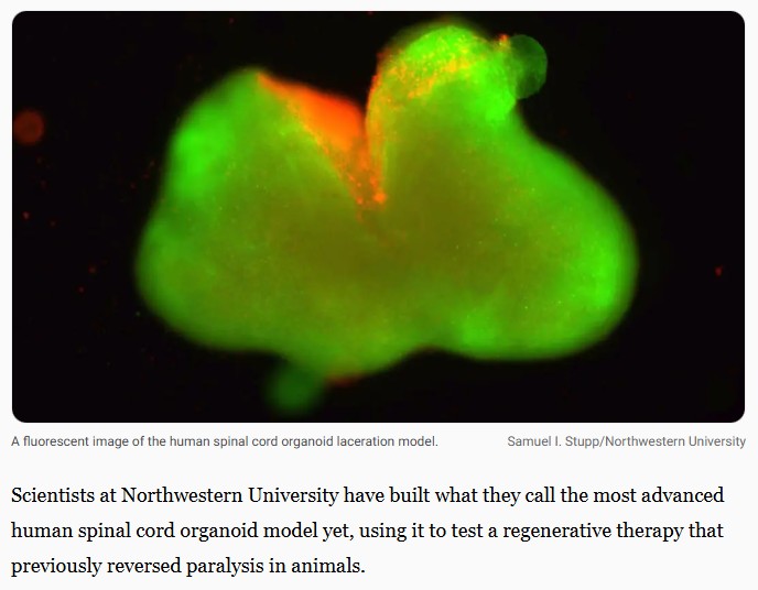 interestingengineering - Breakthrough human spinal cord organoids revive hope for paralysis repair