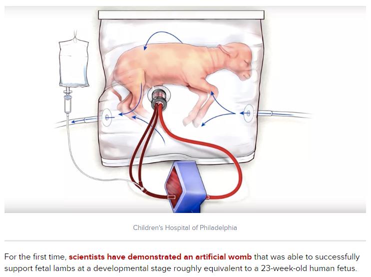 Artificial_womb_grows_lambs__could_treat_premature_births.jpg