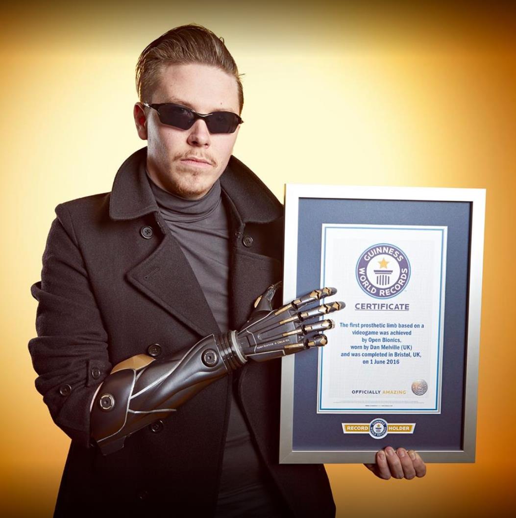 Jensen arm created by Open Bionics.jpg
