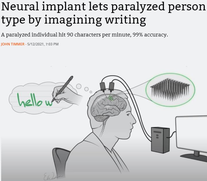 arstechnica.com neural-implant-lets-paralyzed-person-type-by-imagining-writing.jpg
