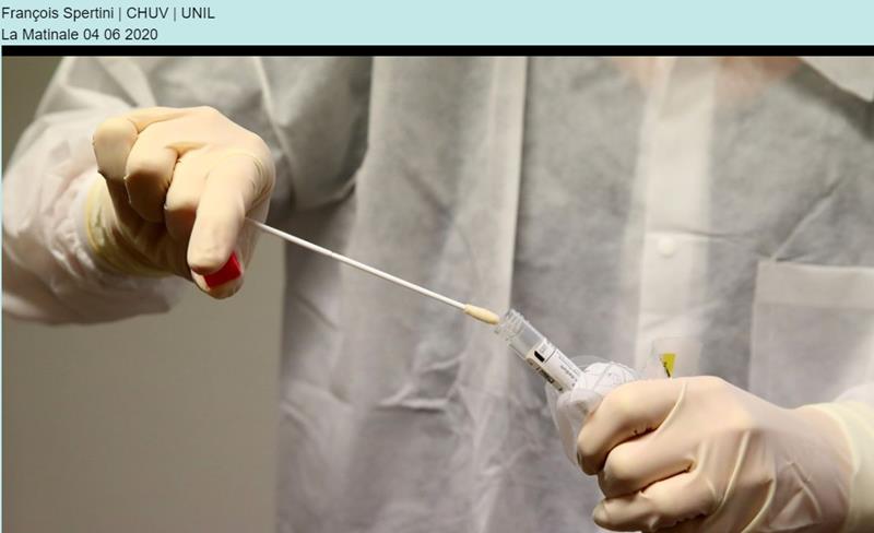 avisdexperts.ch Les tests sérologiques sont-ils fiables pour détecter une contamination au coronavirus.jpg