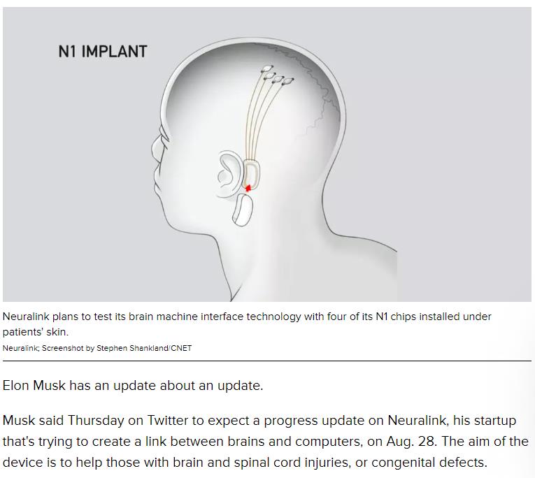 cnet.com elon-musk-says-a-neuralink-update-is-coming-in-august.jpg