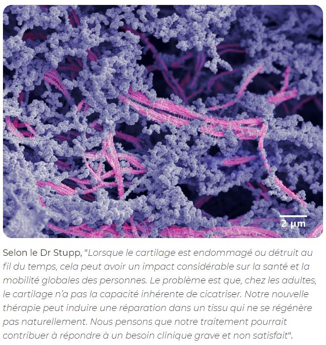 doctissimo - Un gel injectable qui permettrai de régénérer le cartilage