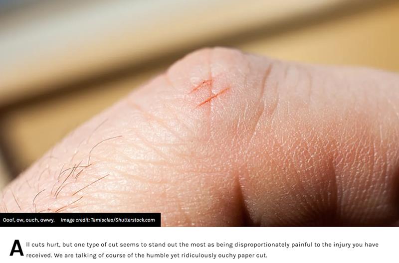 iflscience - This Is Why Papercuts Hurt So Goddamn Much