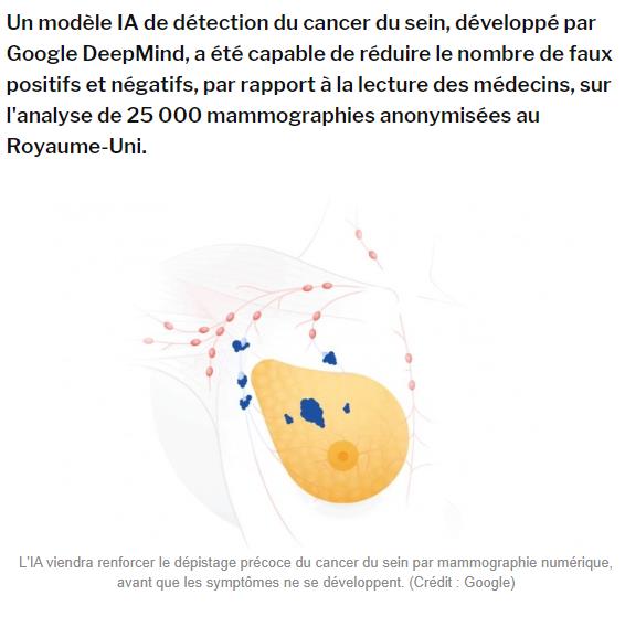 lemondeinformatique.fr lire-avec-l-ia-google-va-aider-les-medecins-a-mieux-depister-les-cancers-du-sein.jpg