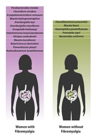 psychologytoday.com the-athletes-way unique-gut-microbiome-composition-may-be-fibromyalgia-marker.jpg
