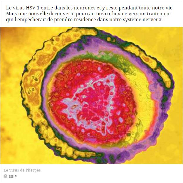sciencesetavenir.fr le-virus-de-l-herpes-derobe-un-moteur-cellulaire-pour-se-faufiler-dans-le-noyau-des-neurones.jpg