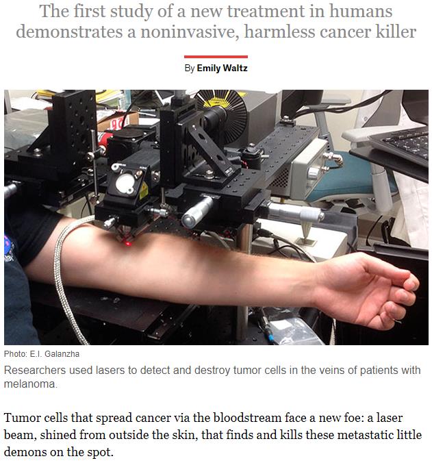 spectrum.ieee.org the-human-os biomedical diagnostics laser-destroys-cancer-cells-circulating-in-the-blood.jpg