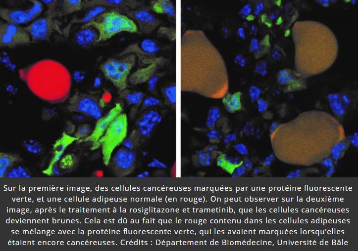 trustmyscience.com des-chercheurs-ont-reussi-a-transformer-des-cellules-cancereuses-en-graisse-pour-stopper-leur-proliferation.jpg