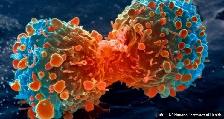 trustmyscience.com un-virus-attaque-le-cancer-du-cerveau-et-stimule-le-systeme-immunitaire.jpg