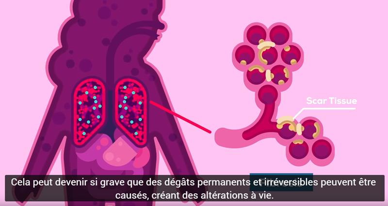 youtube.com Kurzgesagt – In a Nutshell - Le Coronavirus expliqué et Ce que vous devez faire.jpg